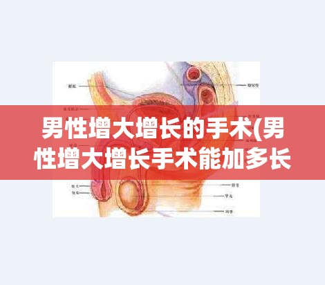男性增大增长的手术(男性增大增长手术能加多长) 男性增大增长的手术(男性增大增长手术能加多长)