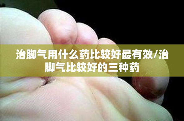 治脚气用什么药比较好最有效/治脚气比较好的三种药 治脚气用什么药比较好最有效/治脚气比较好的三种药